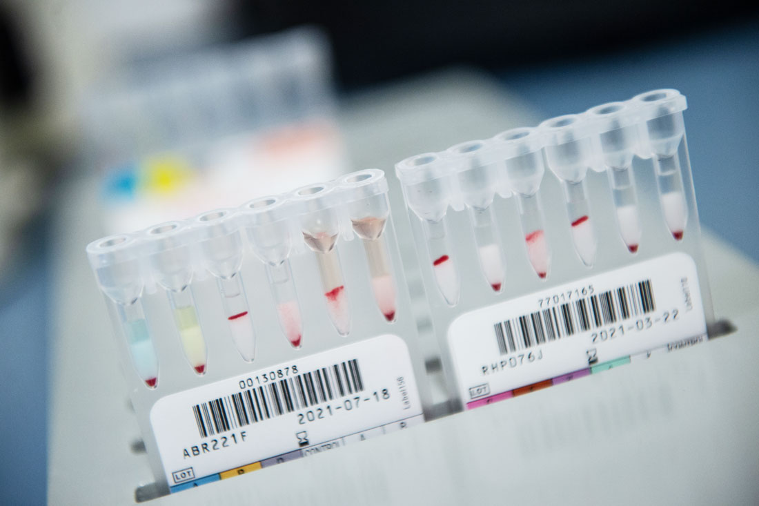 проверяют ли кровь на наркотики доноров